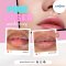 PINK LIPS  | เลเซอร์ปากชมพู