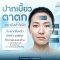 ปากเบี้ยว ตาตก อย่าเพิ่งเข้าใจผิด! รู้จักโรคอัมพาตใบหน้า (Bell's palsy) และวิธีรักษา