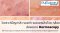 Dermatology Insights: วิเคราะห์ปัญหาสิว รอยดำ รอยแดงสิวด้วย กล้องส่องขยาย Dermoscopy to analyze Acne, Post Acne Erythema & Hyperpigmentation 