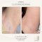 EVE'S ครีมรักแร้ Anti Dark Armpit & Bum Bum