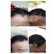 CHEVEUX HAIR GROWTH SERUM