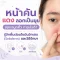 เซฟเดิร์ม หน้าแห้ง ลอก ทาอะไรดี? วิธีรับมือและรักษาโรคต่อมไขมันอักเสบ